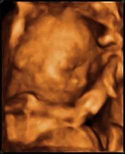 4D ultrasound image of human baby in the womb, taken at 20 weeks