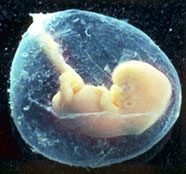 Human unborn baby in the amniotic sac. Photo courtesy Eden Communications Â©