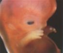 An unborn human baby at just 7 weeks from conception.