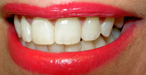 A row of teeth